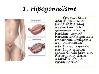 HIPOGONADISME